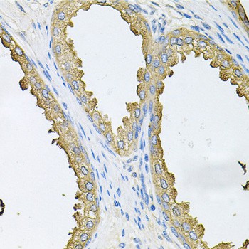 Immunohistochemistry of paraffin-embedded Human prostate using ABL1 Polyclonal Antibody at dilution of 1:100 (40x lens).