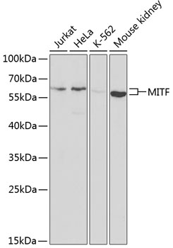 Western blot analysis of extracts of various cell lines using MITF Polyclonal Antibody at dilution of 1:1000.