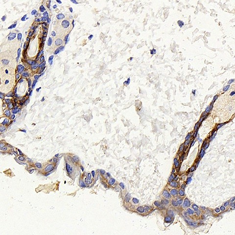 Immunohistochemistry analysis of paraffin-embedded mouse skin  using CK-17 Polyclonal Antibody at dilution of 1:400.