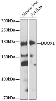 Western blot analysis of extracts of various cell lines using DUOX1 Polyclonal Antibody at 1:1000 dilution.