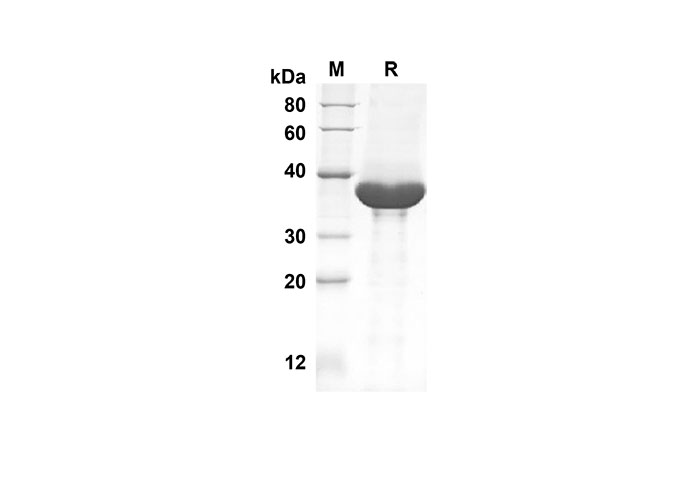 Recombinant Mouse IL-11 Protein(Sumo Tag)-产品推荐-1