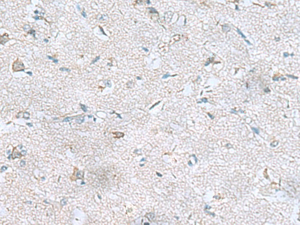 Immunohistochemistry of paraffin-embedded Human brain tissue  using GFRA1 Polyclonal Antibody at dilution of 1:65(?200)