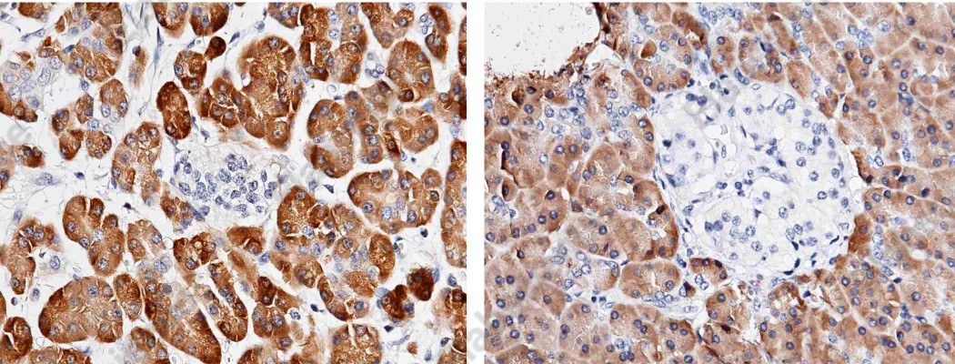 Carboxypeptidase A2/CPA2 Monoclonal Antibody - 1