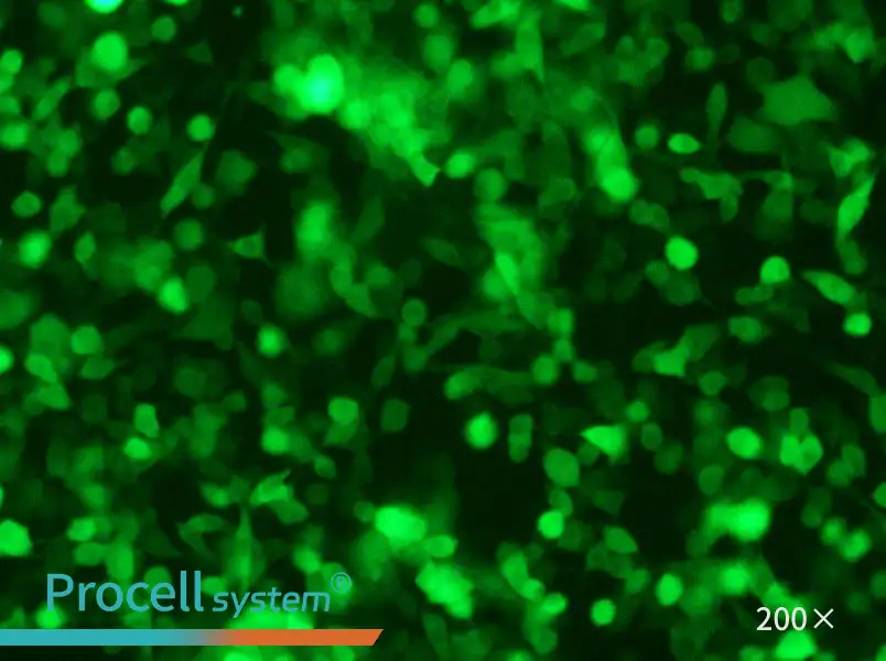 RM-1-GFP Cell Complete Medium - 4