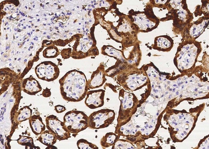 Recombinant PNP Monoclonal Antibody-searchlist-1