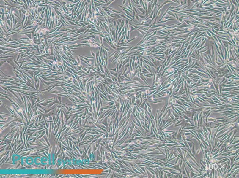 MEL270 Cell Complete MediumMEL270 Cell Complete Medium - 2