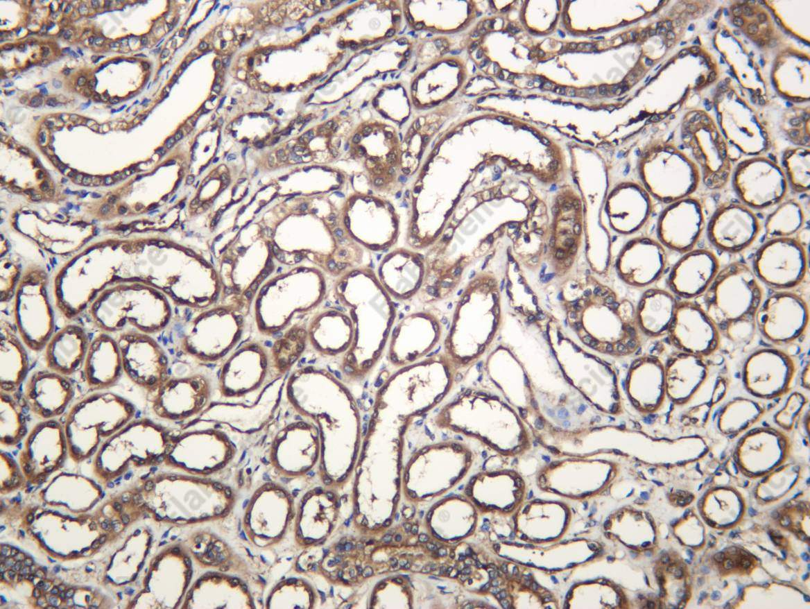 Recombinant DAP 1 Monoclonal Antibody - 1