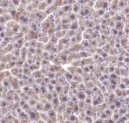 Recombinant FABP1 Monoclonal Antibody - 3