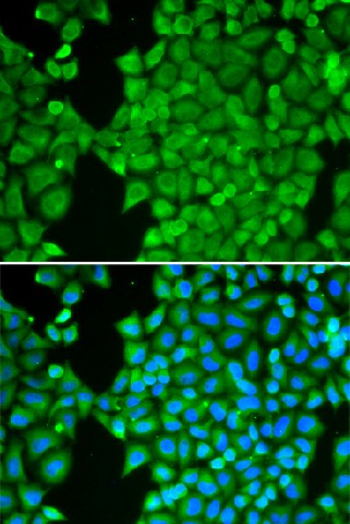 Immunofluorescence analysis of HeLa cells using CA3 Polyclonal Antibody