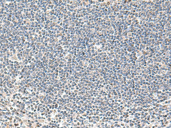 Immunohistochemistry of paraffin-embedded Human tonsil tissue  using IFNA2 Polyclonal Antibody at dilution of 1:40(?200)