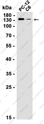 Recombinant Ubiquitin Conjugation Factor E4 B Monoclonal Antibody - 1
