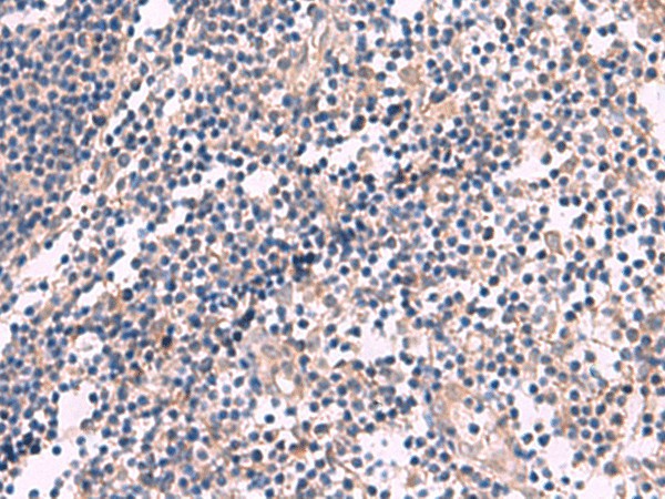 Immunohistochemistry of paraffin-embedded Human tonsil tissue  using KCNN3 Polyclonal Antibody at dilution of 1:60(?200)