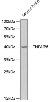 Western blot analysis of extracts of mouse brain using TNFAIP6 Polyclonal Antibody at 1:1000 dilution.