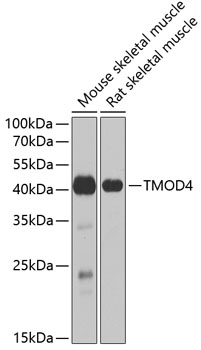 Western blot analysis of extracts of various cell lines using TMOD4 Polyclonal Antibody at 1:1000 dilution.