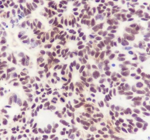 Recombinant MBD2 Monoclonal Antibody - small - 2