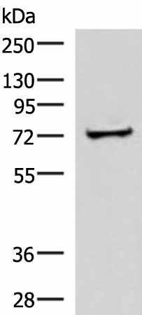 Western blot analysis of Human liver tissue lysate  using ZNF263 Polyclonal Antibody at dilution of 1:500