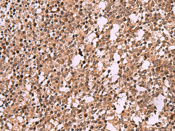 Immunohistochemistry of paraffin-embedded Human tonsil tissue  using IST1 Polyclonal Antibody at dilution of 1:40(?200)