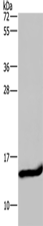 Western Blot analysis of Mouse small intestine tissue using FABP2 Polyclonal Antibody at dilution of 1:650