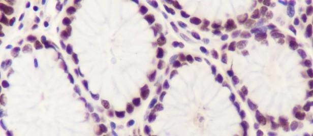 Recombinant MBD2 Monoclonal Antibody - small - 3