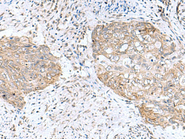 PAM16 Polyclonal Antibody - small - 2
