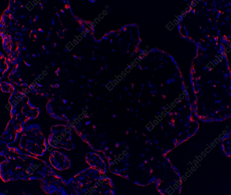 Recombinant PI3-Kinase p85 α Monoclonal Antibody - 6