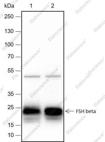 Recombinant FSH beta Monoclonal Antibody - 1