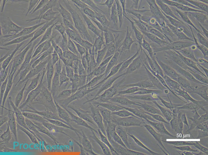 Human Mammary Cancer Fibroblast Complete Medium - small - 6