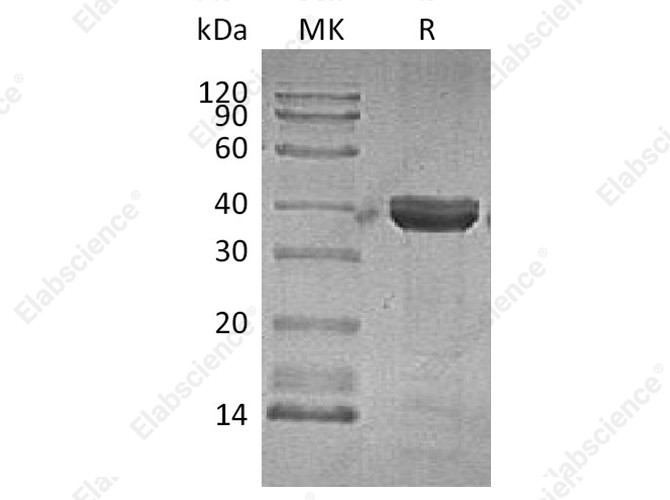 Recombinant Human Cathepsin Z Protein (His Tag) - 1