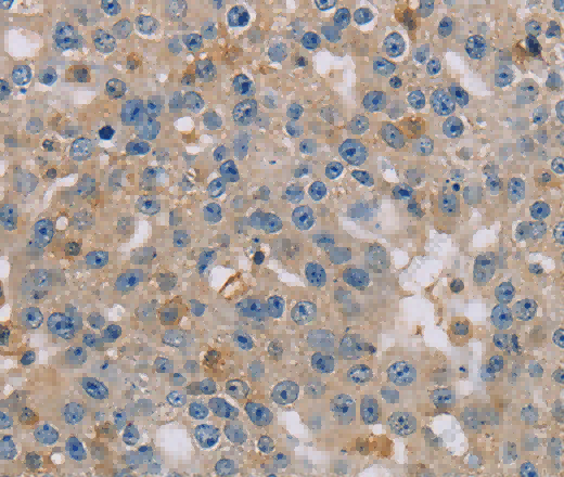 CLIC1 Polyclonal Antibody - 3