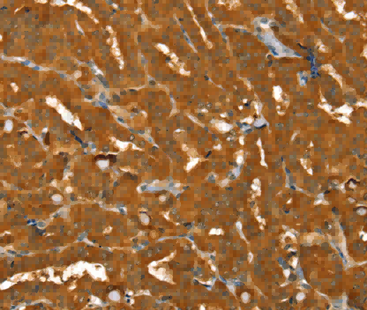 PYGM Polyclonal Antibody - 2
