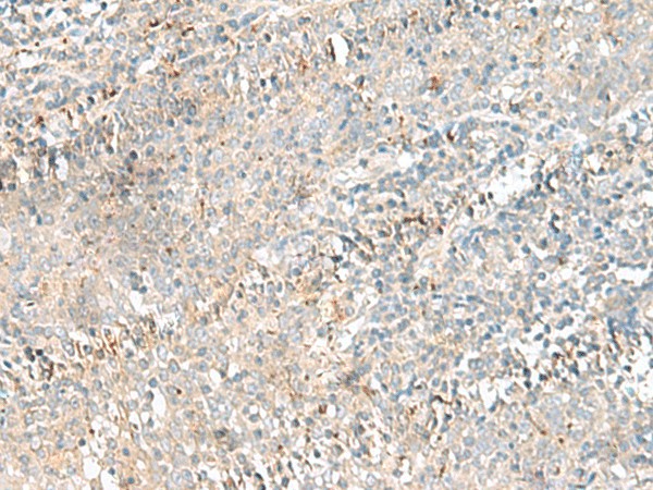 Immunohistochemistry of paraffin-embedded Human tonsil tissue  using CTRB1 Polyclonal Antibody at dilution of 1:55(?200)