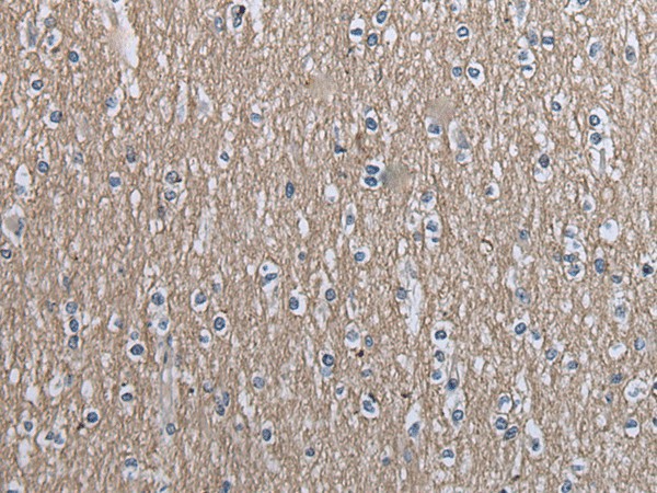 Immunohistochemistry of paraffin-embedded Human brain tissue  using SLC39A14 Polyclonal Antibody at dilution of 1:40(?200)