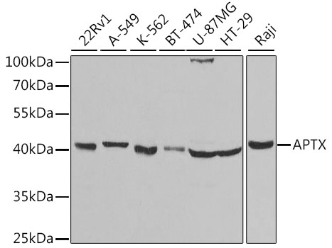 Western blot analysis of extracts of various cell lines using APTX Polyclonal Antibody at dilution of 1:1000.