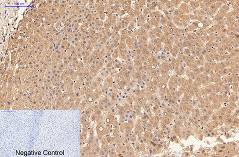 Immunohistochemistry of paraffin-embedded Human liver tissue using alpha Lactalbumin Monoclonal Antibody at dilution of 1:200.