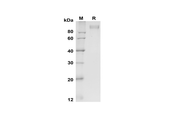 Recombinant Mouse Fas/TNFRSF6/CD95 Protein(Fc Tag)-产品推荐-1