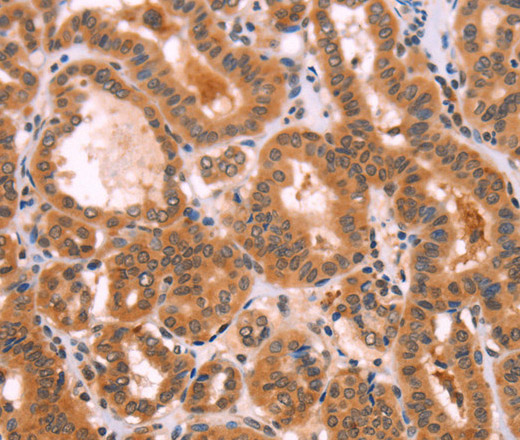 Immunohistochemistry of paraffin-embedded Human brain using NCEH1 Polyclonal Antibody at dilution of 1:80