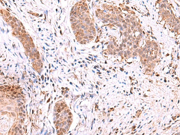 RUSC1 Polyclonal Antibody - small - 2