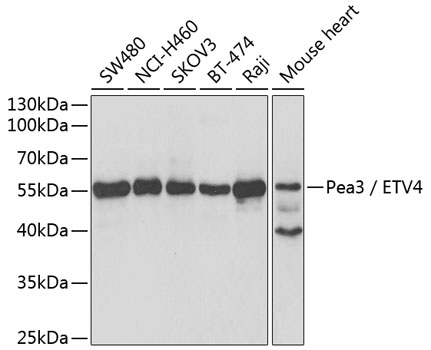 Western blot analysis of extracts of various cell lines using Pea3 / ETV4 Polyclonal Antibody at dilution of 1:1000.