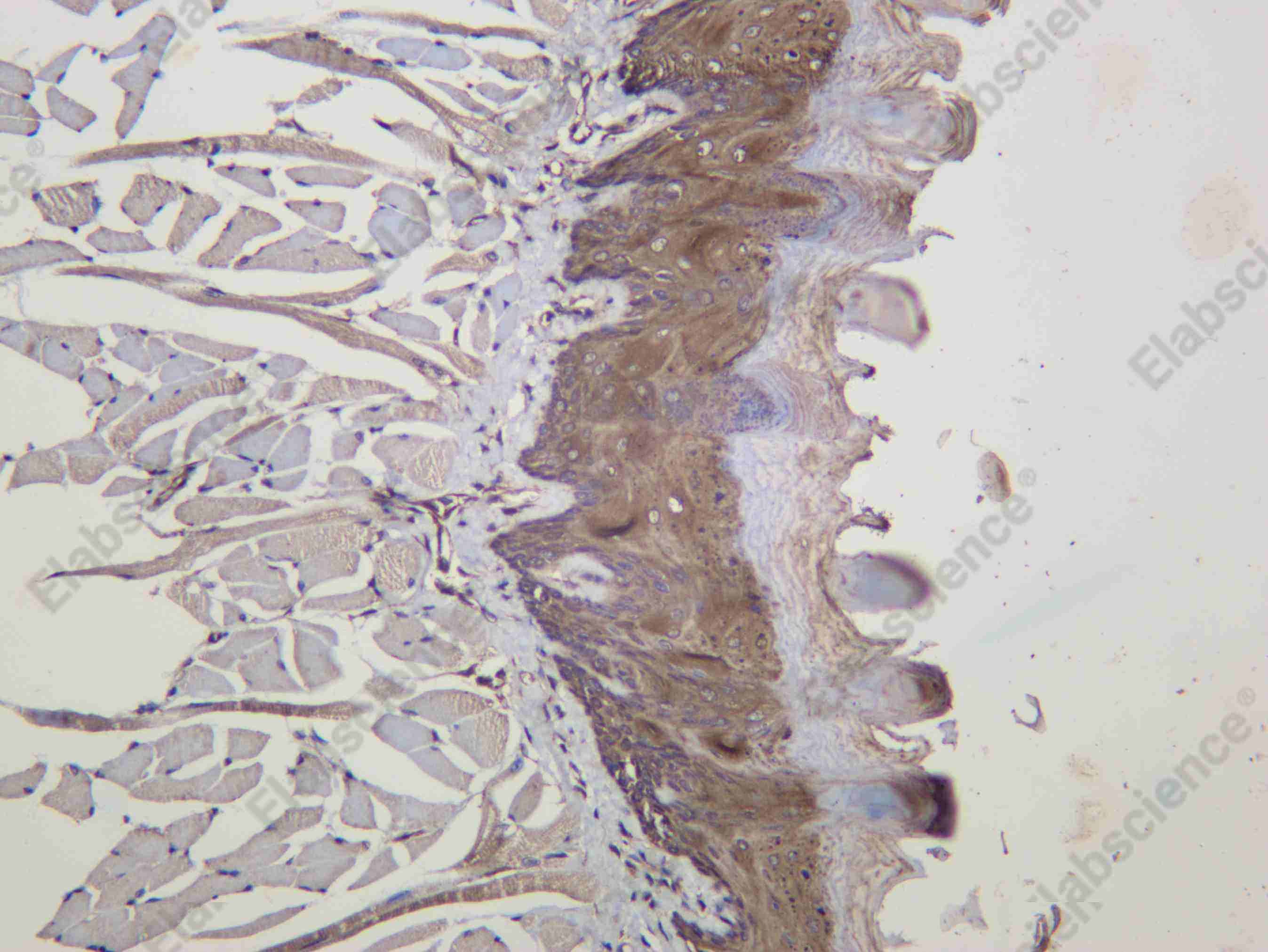 Recombinant IRS2 Monoclonal Antibody - 2