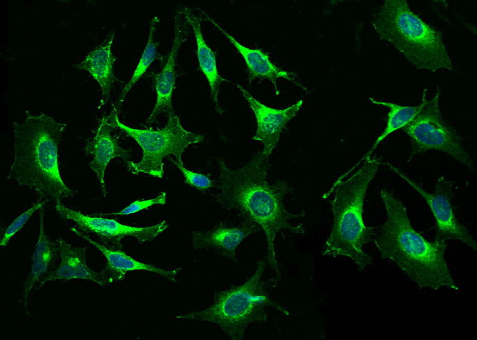 Beta-2 microglobulin/B2M Monoclonal Antibody - small - 2