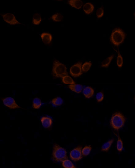 Immunofluorescence analysis of NIH/3T3 cells using Caspase-9 Polyclonal Antibody at dilution of  1:100. Blue: DAPI for nuclear staining.