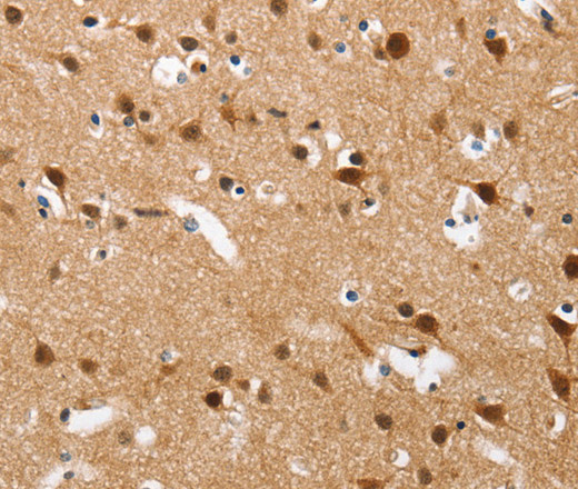 Immunohistochemistry of paraffin-embedded Human brain  tissue using CXCL14 Polyclonal Antibody at dilution 1:60