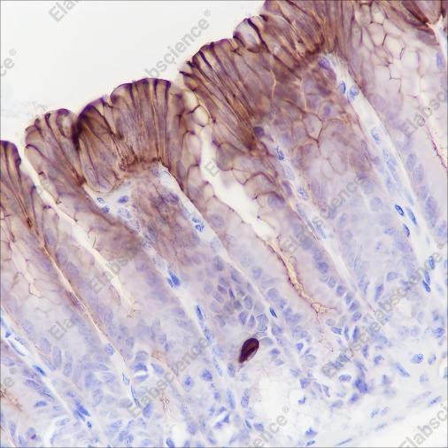 Recombinant Phospho-Girdin (Tyr1765) Monoclonal Antibody - 2