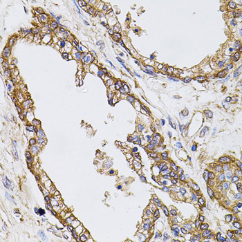 Immunohistochemistry of paraffin-embedded Human prostate using CAST Polyclonal Antibody at dilution of 1:100 (40x lens).