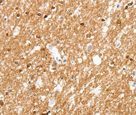 Immunohistochemistry of paraffin-embedded Human brain  using AMZ1 Polyclonal Antibody at dilution of 1:80