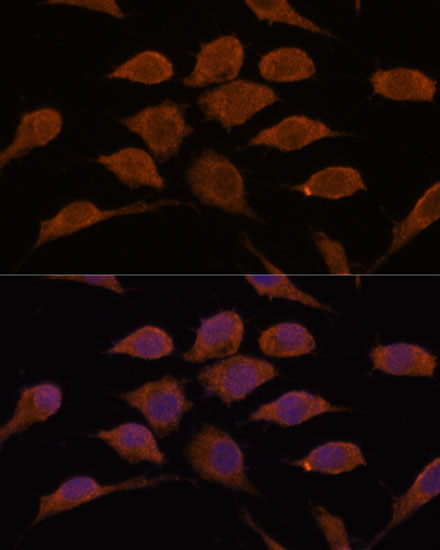 Immunofluorescence analysis of L929 cells using USP19 Polyclonal Antibody at dilution of  1:100. Blue: DAPI for nuclear staining.