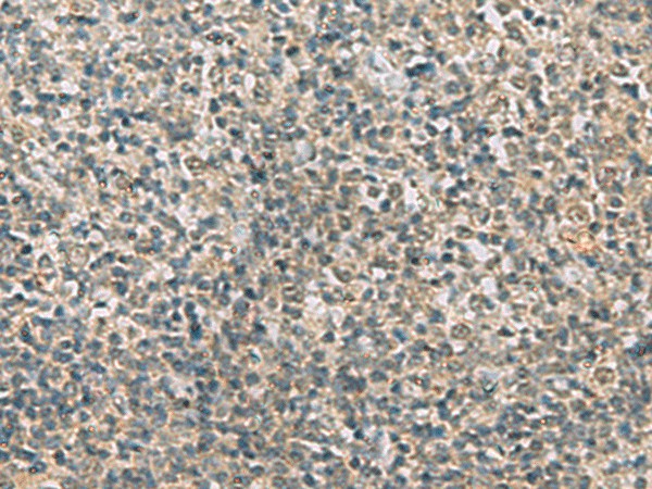 Immunohistochemistry of paraffin-embedded Human tonsil tissue  using RAB3IP Polyclonal Antibody at dilution of 1:60(?200)