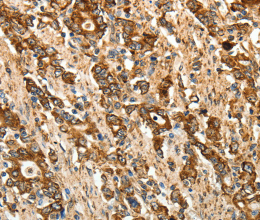CALR Polyclonal Antibody - 2