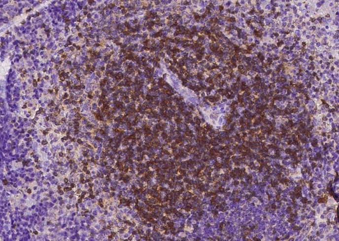 Recombinant CD27/TNFRSF7 Monoclonal Antibody-searchlist-1