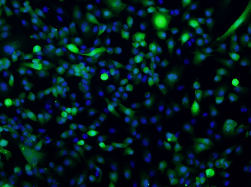 ACHN-GFP Cell Complete MediumACHN-GFP Cell Complete Medium - 2